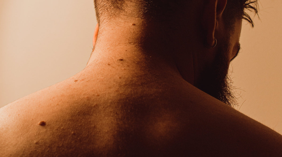 Scoliosis – Comfee